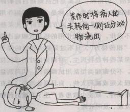 新生儿癫痫的